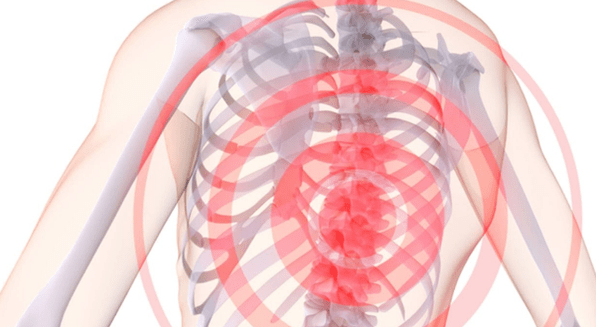 sāpes mugurkaulā ar krūšu kurvja osteohondrozi